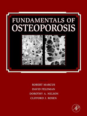 cover image of Fundamentals of Osteoporosis